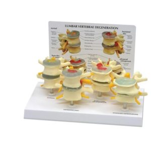 Set modela kralježaka u 4 faze